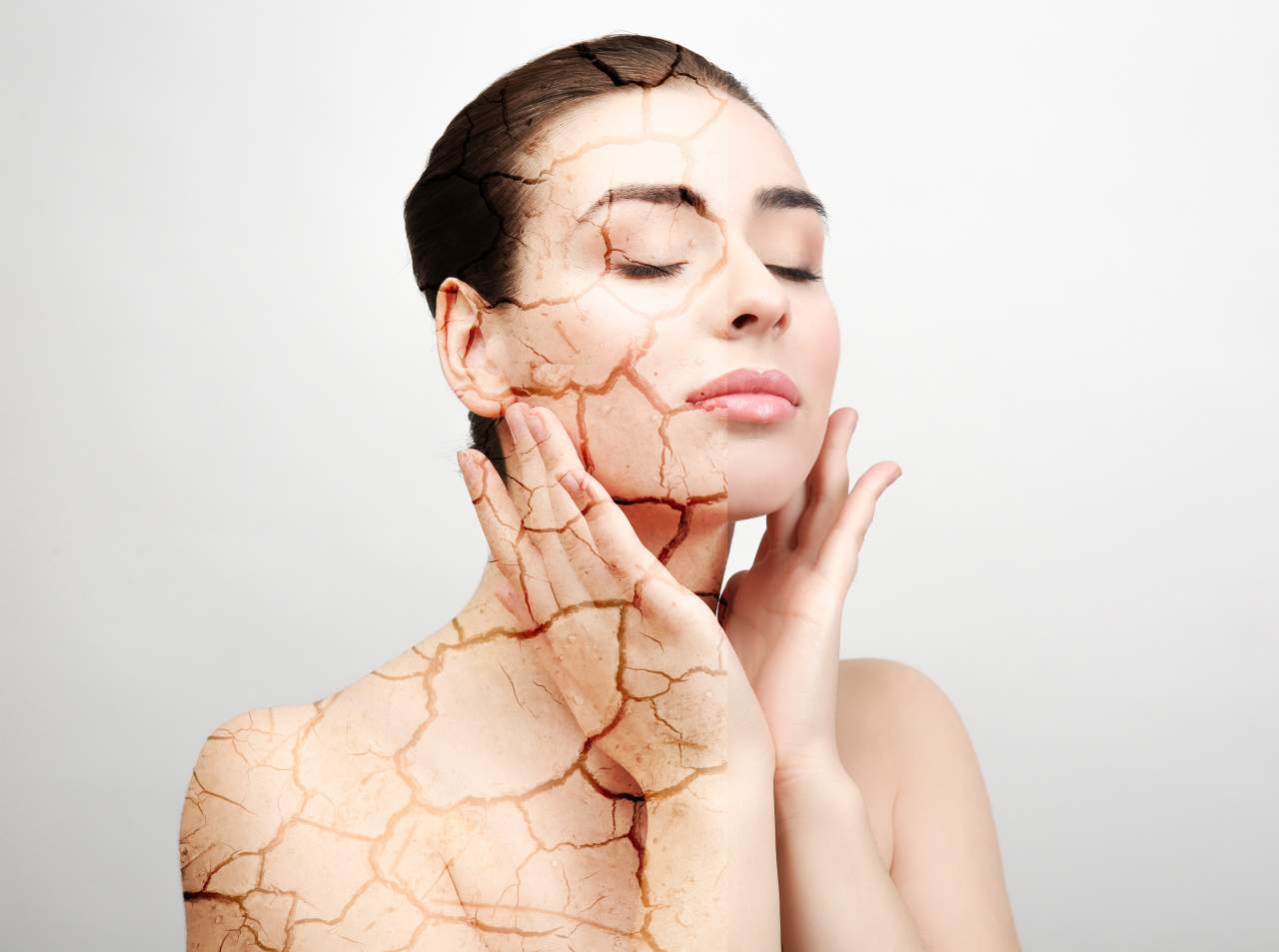 La técnica Microneedling para rejuvenecer el rostro: Montserrat Travé