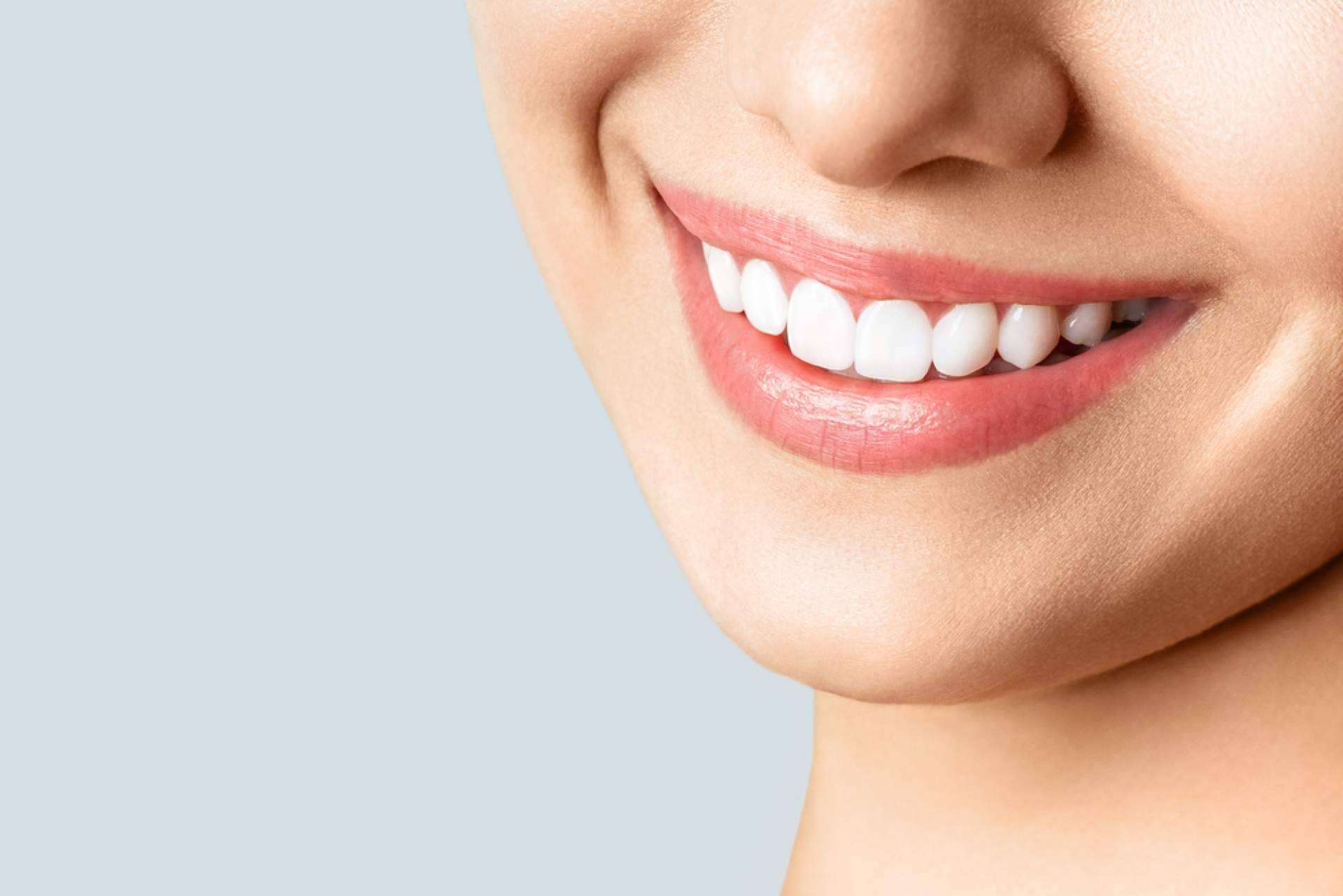 Aplicarse microcarillas dentales sin tallado dental de la mano de Carlos Saiz Smile