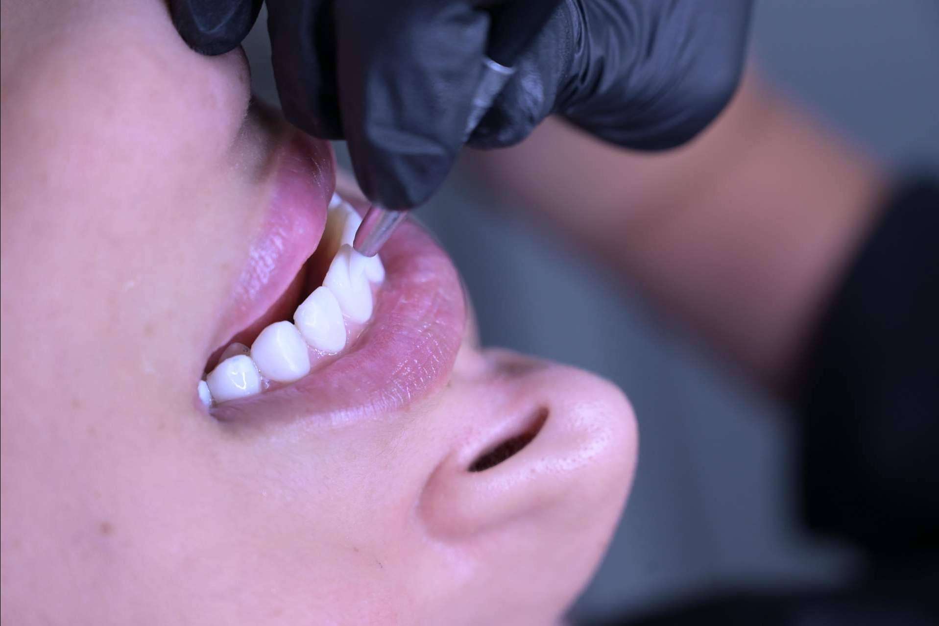 Denty Dent mejora la sonrisa de sus pacientes con tratamientos de estética dental