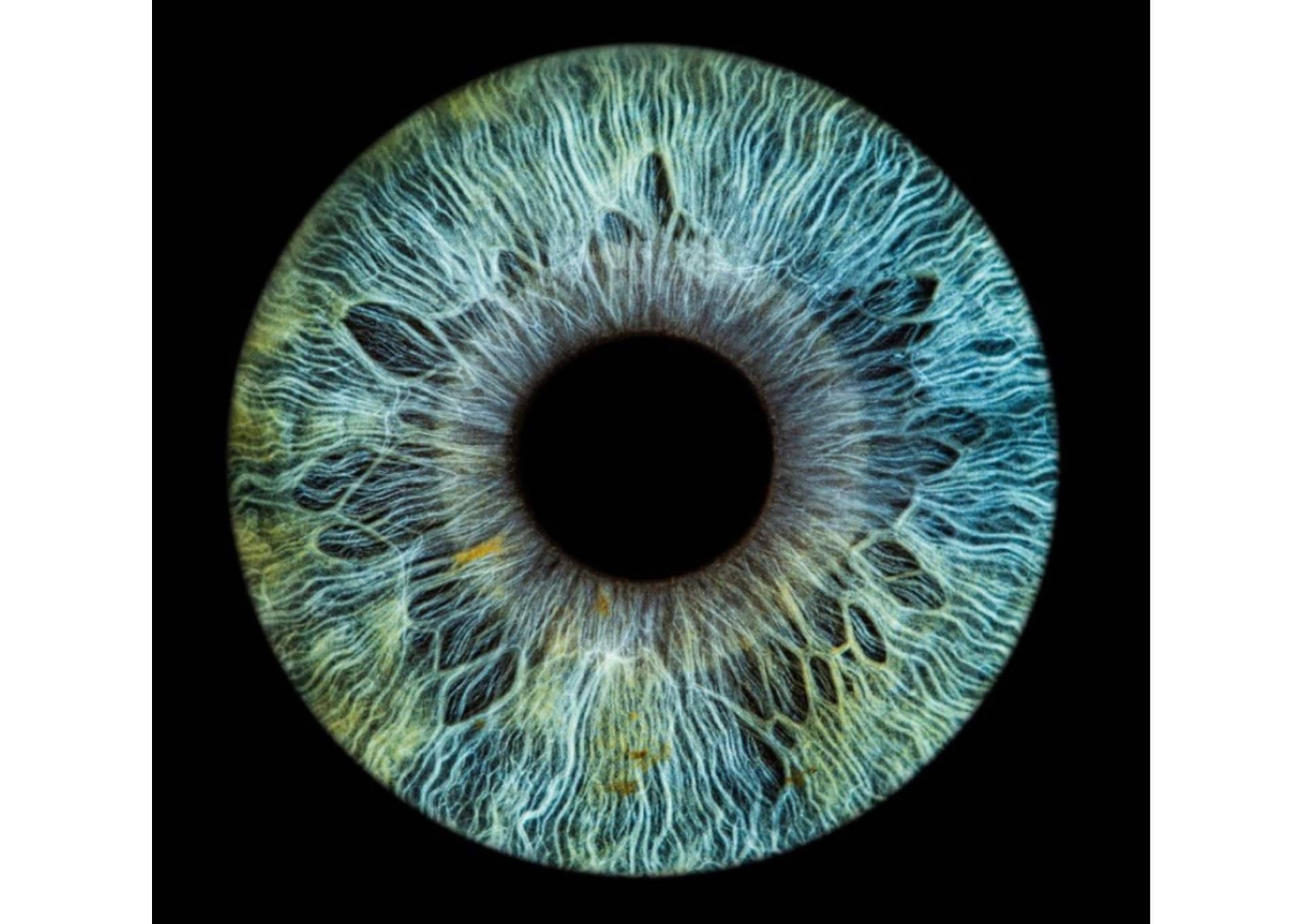 El software con tecnología puntera para evaluar el color de los ojos de la clínica Eyecos