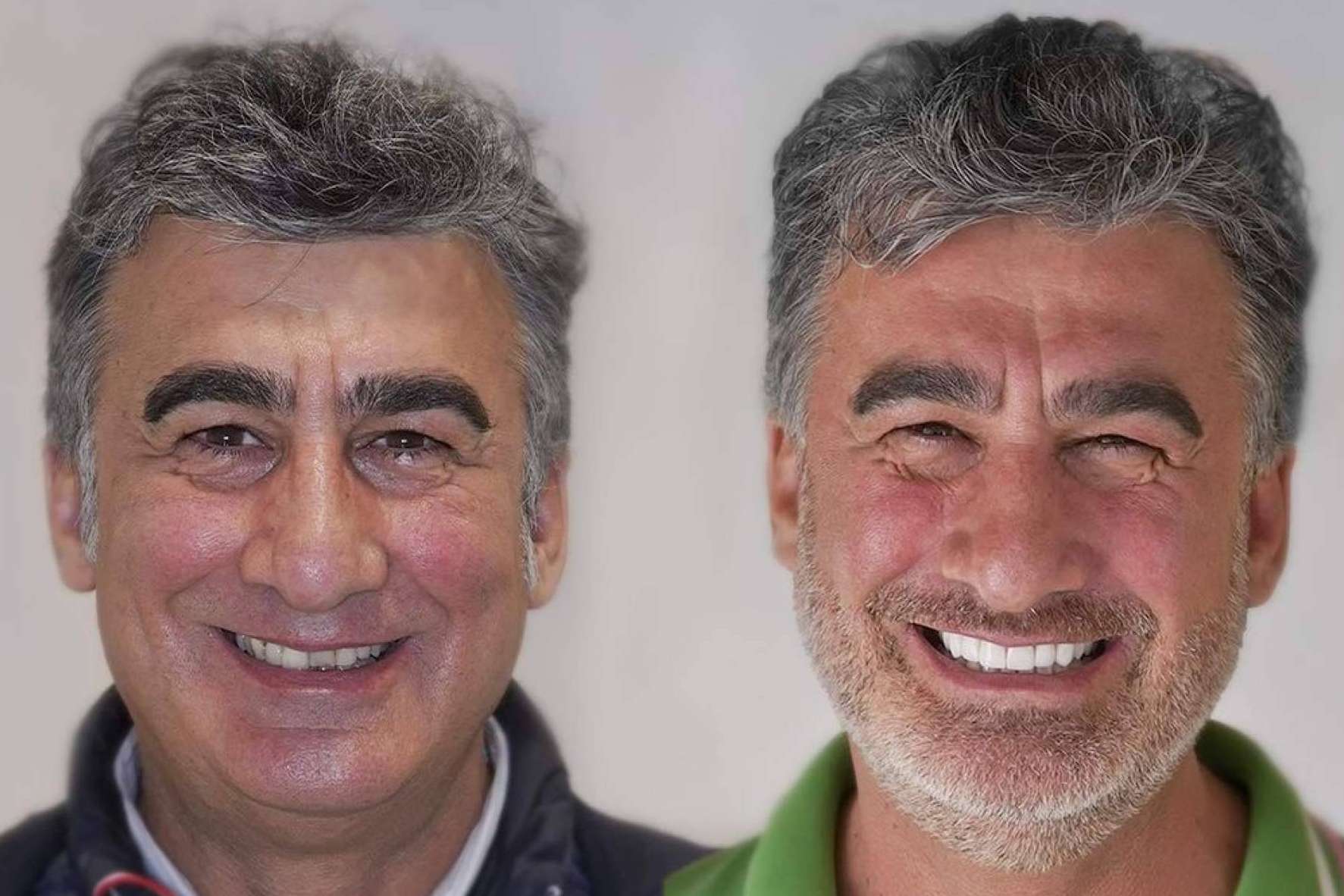 Denty Dent, expertos en tratamientos de estética dental