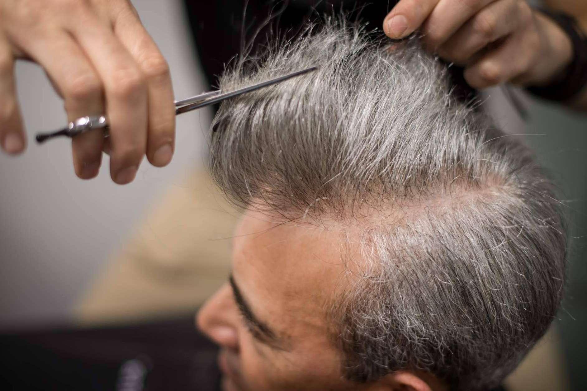 Hair Inspira cuenta con expertos en prótesis capilares