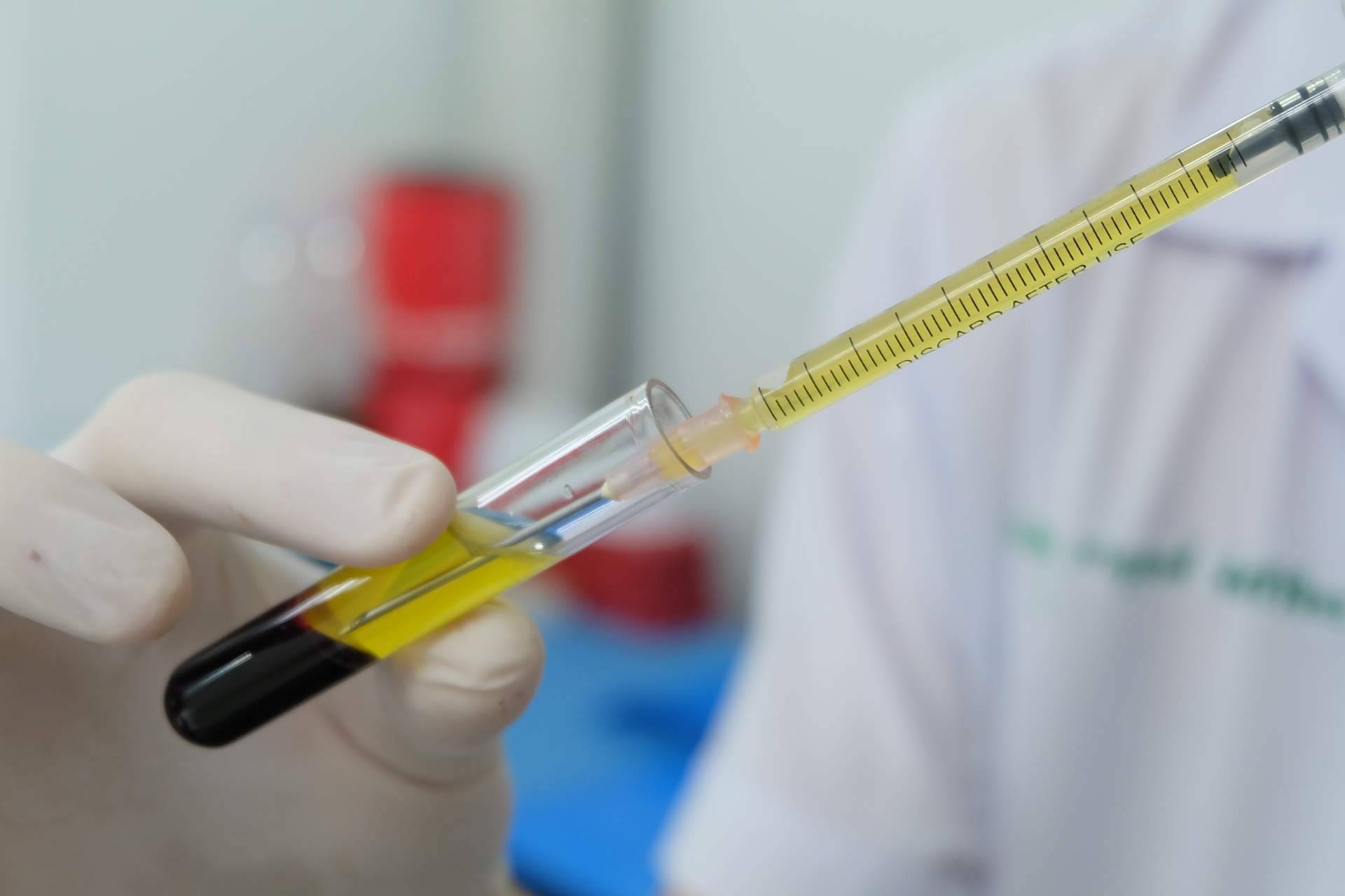 El papel del plasma rico en plaquetas en la traumatología