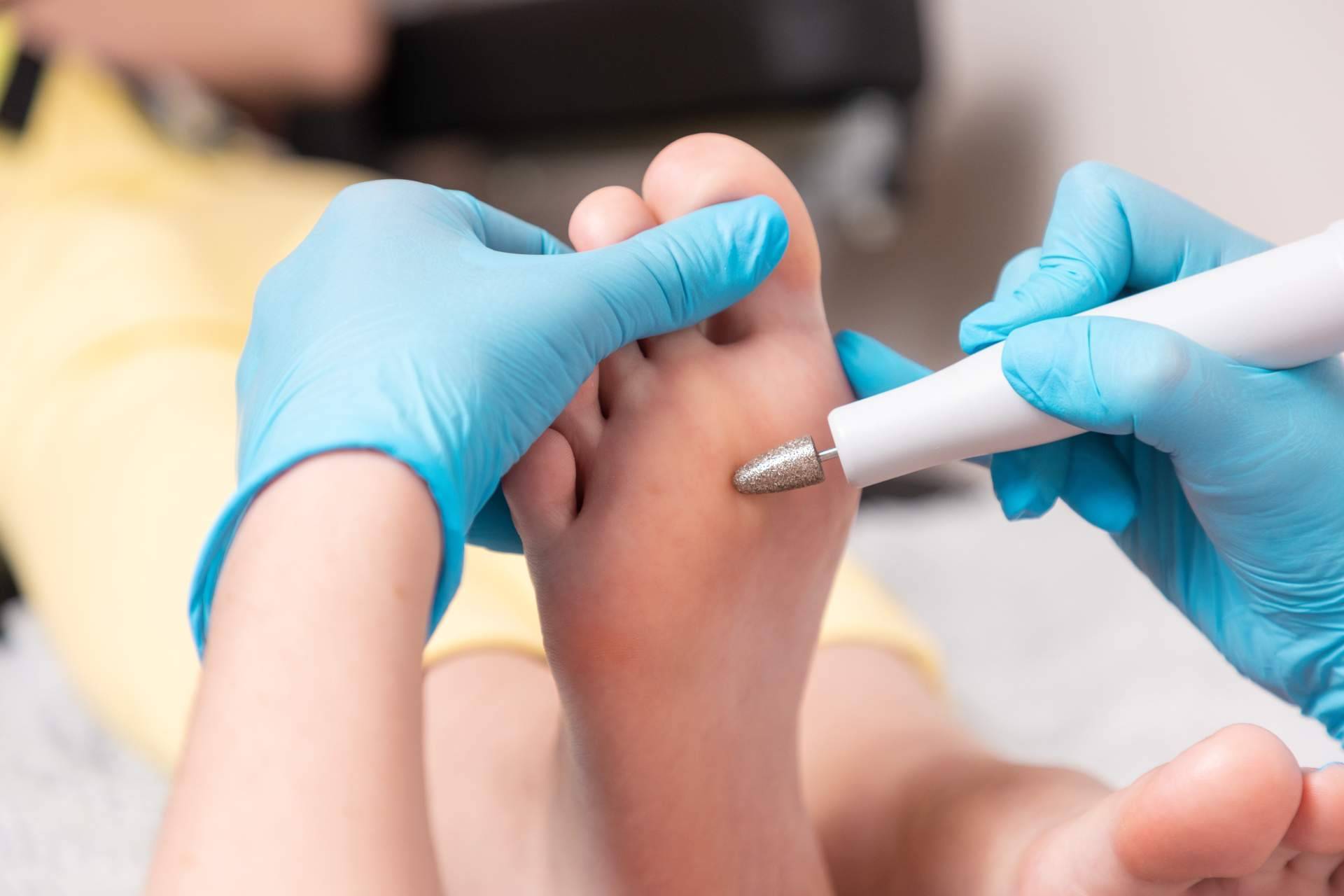 Podología en Madrid de la mano del Centro Médico El Pilar