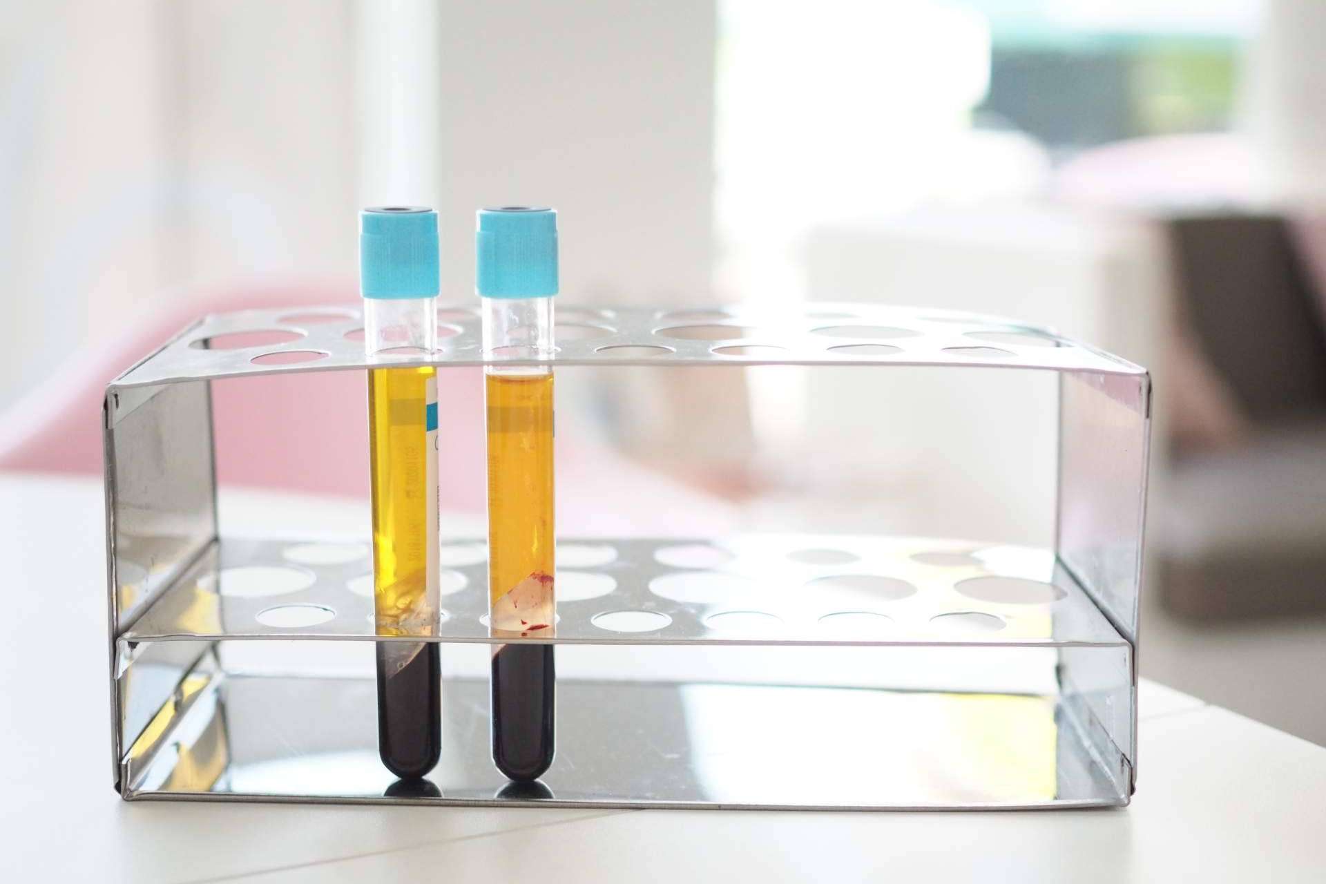 Las ventajas del innovador tratamiento de plasma rico en plaquetas de Centro Estética El Pilar