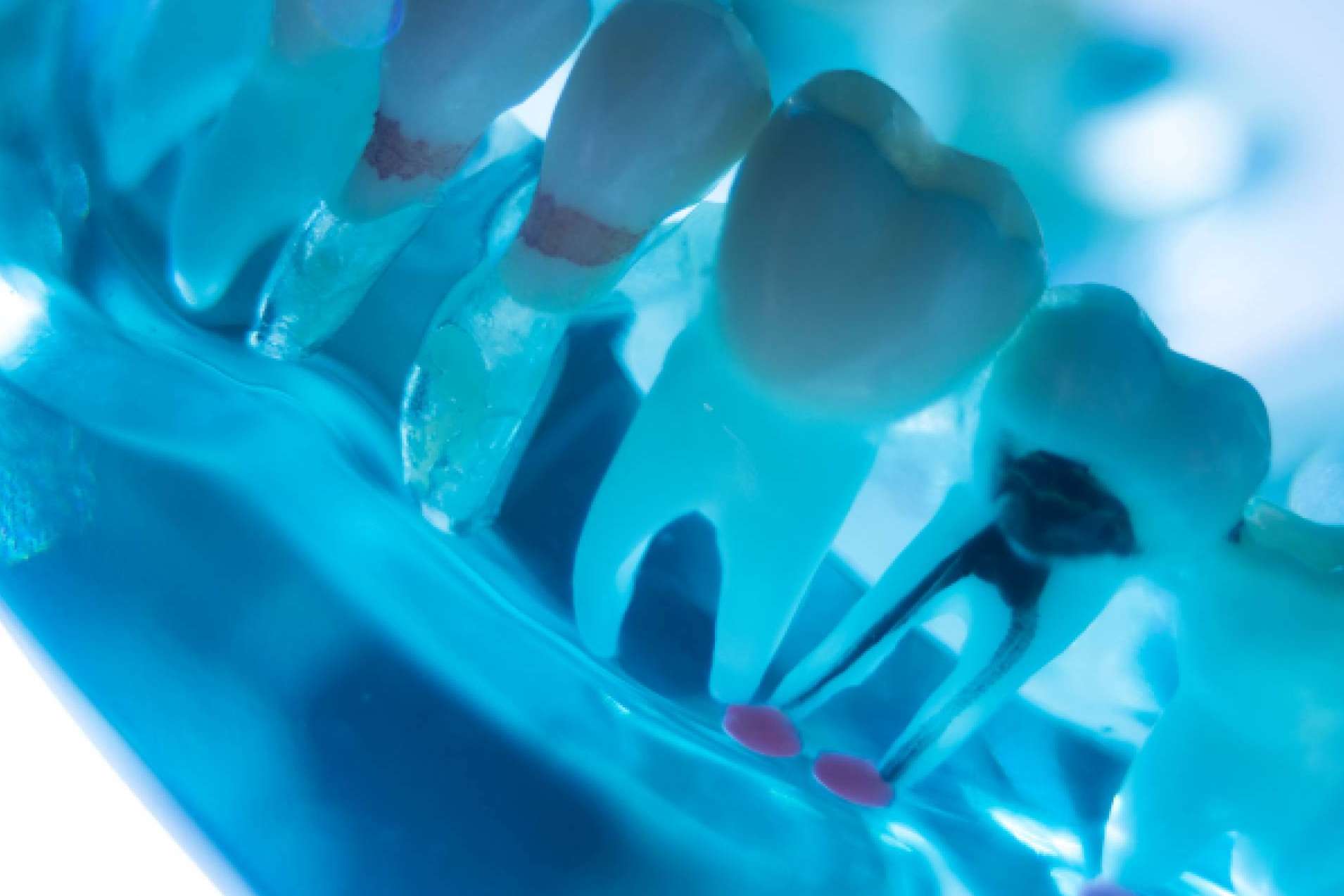 Prevención y tratamiento para diferentes enfermedades de las encías, con Denty Dent