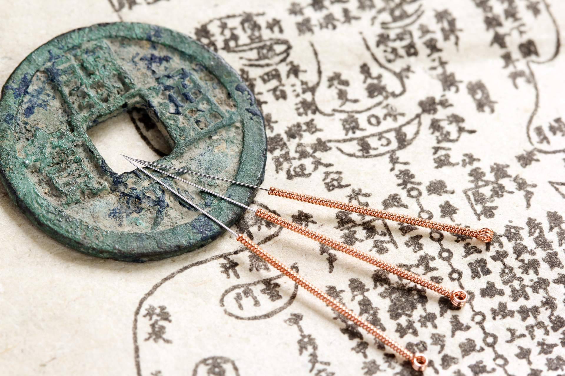 La Medicina Tradicional China ofrece una forma no invasiva de lograr la curación