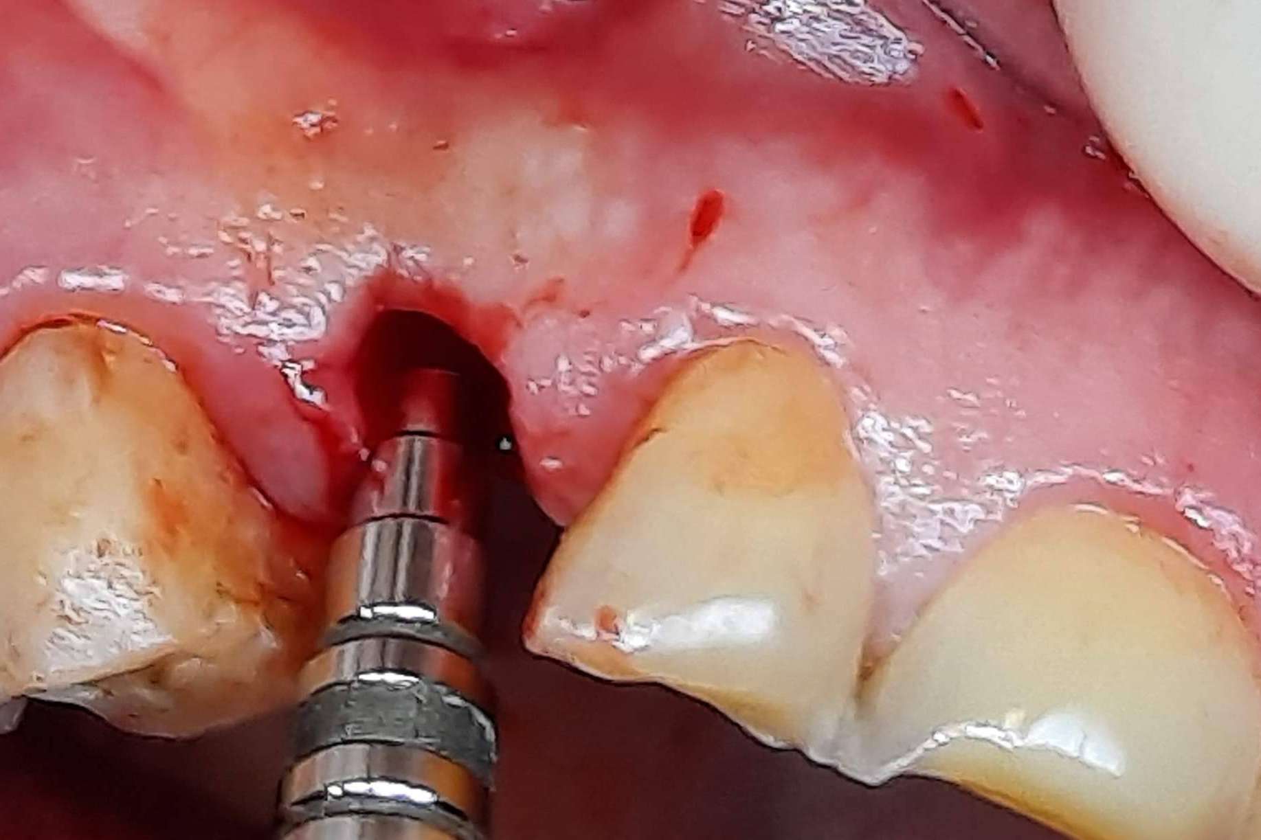 Clínica Biorigenera habla del poder de la sanación interna