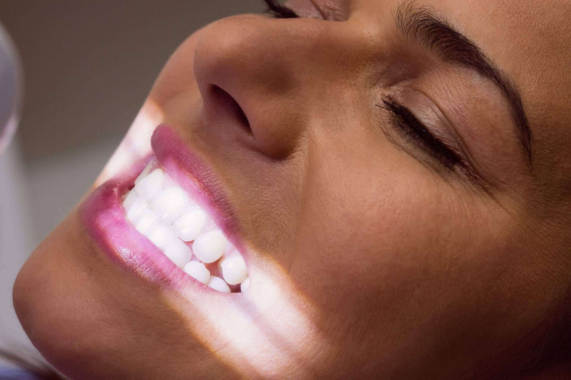 Cuáles son los tratamientos de estética dental más demandados para este verano