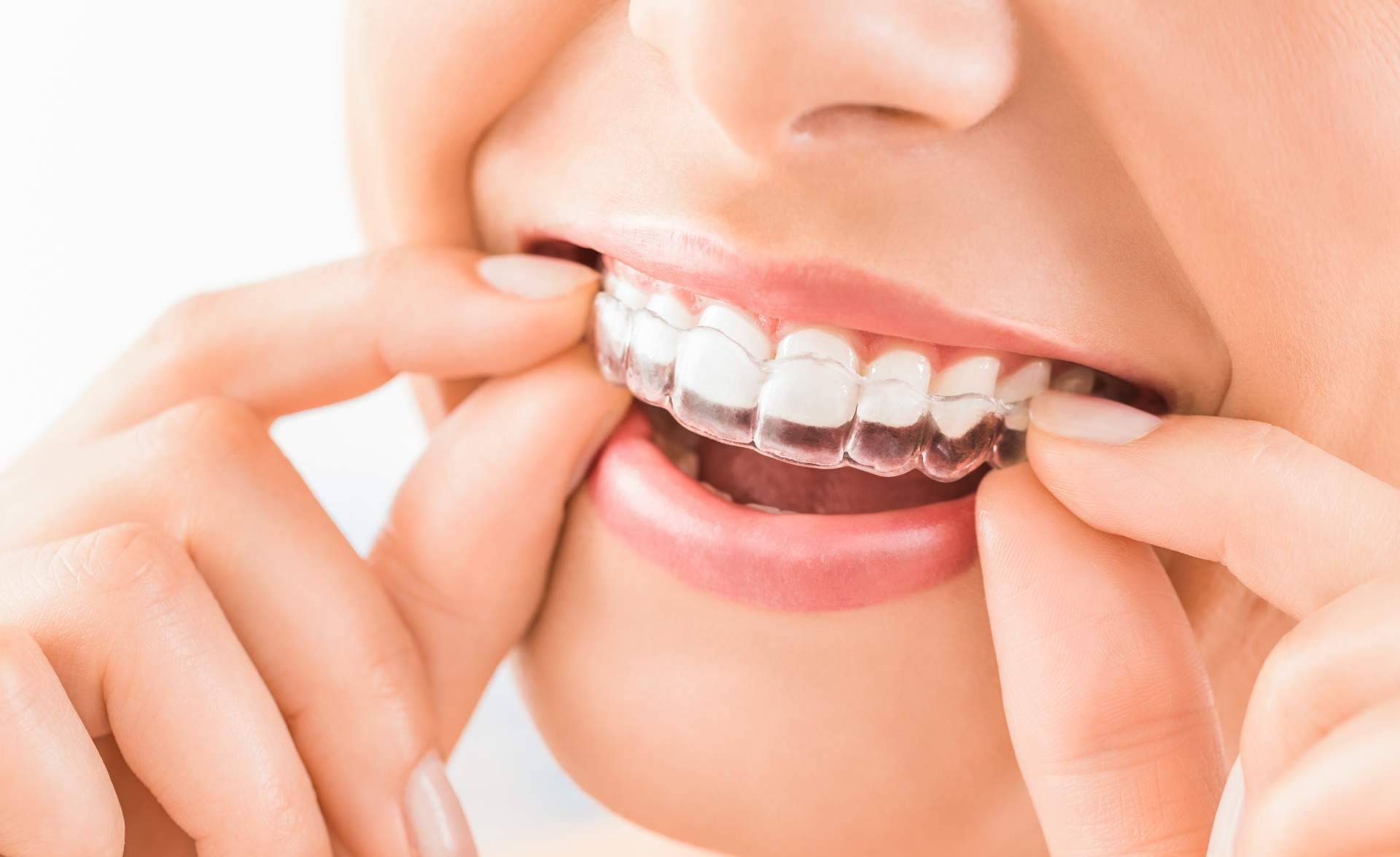 La Clínica Dental en Zafra Instituto Dental Oris destaca por su enfoque integral en implantología y ortodoncia personalizada
