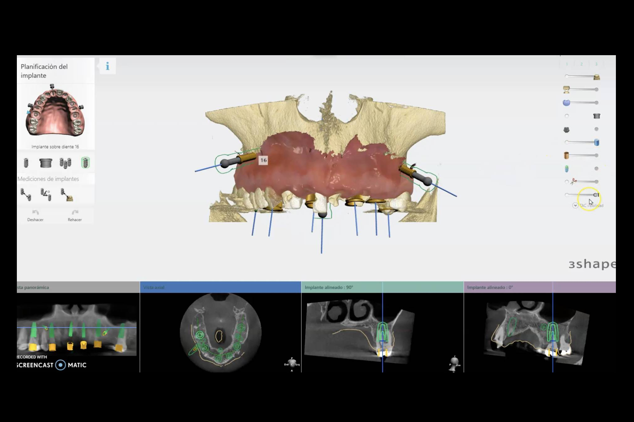 Odontología avanzada en Sabadell; cómo la tecnología redefine la práctica clínica